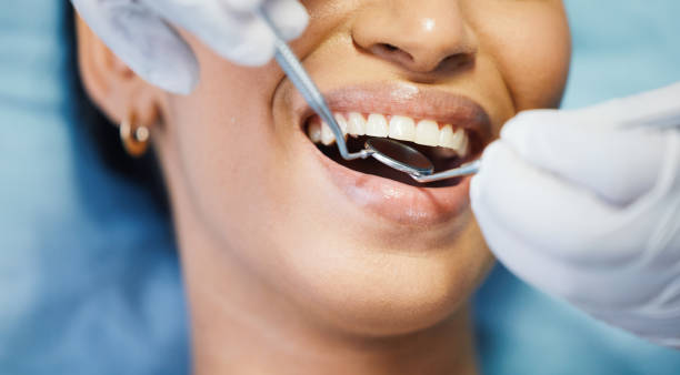 Best Urgent Care for Lost Fillings or Crowns in Struthers, OH