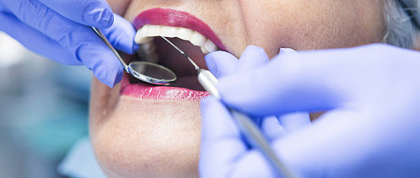 Best Emergency Dental Care for Broken or Chipped Teeth in Struthers, OH